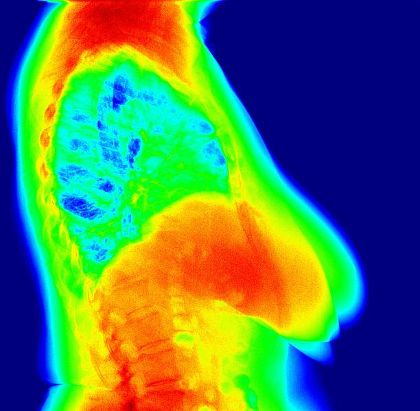 Exame termografia preço​