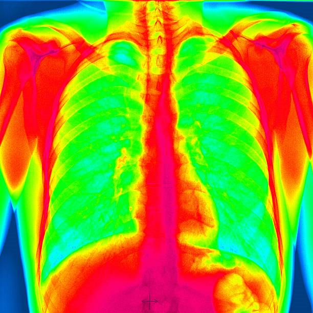 Termografia exame​