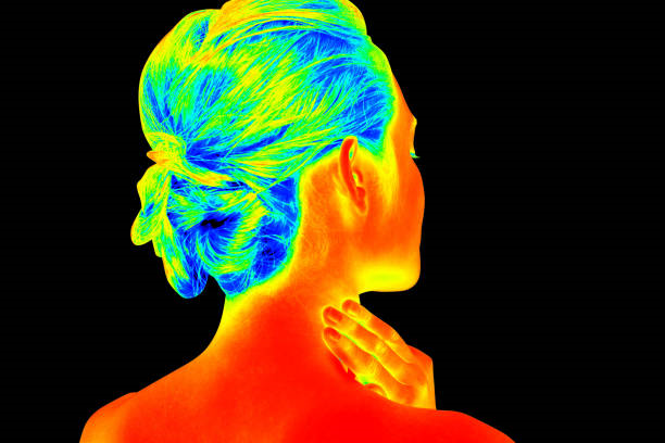 Termografia fisioterapia​